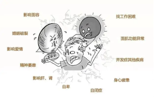 【高医科普】神经内科之春季面瘫，“吹”来之祸 宝鸡高新医院